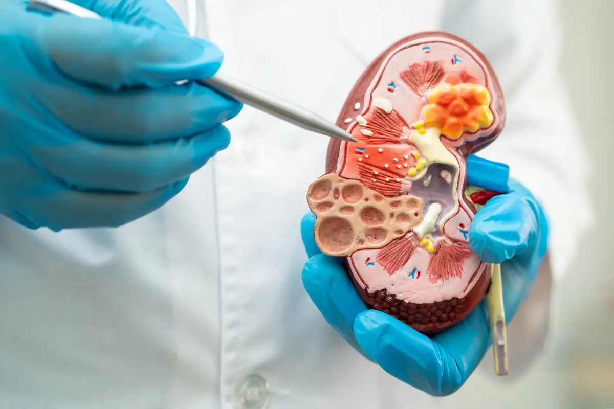Kidney Transplantation in China Kidney Transplantation in China